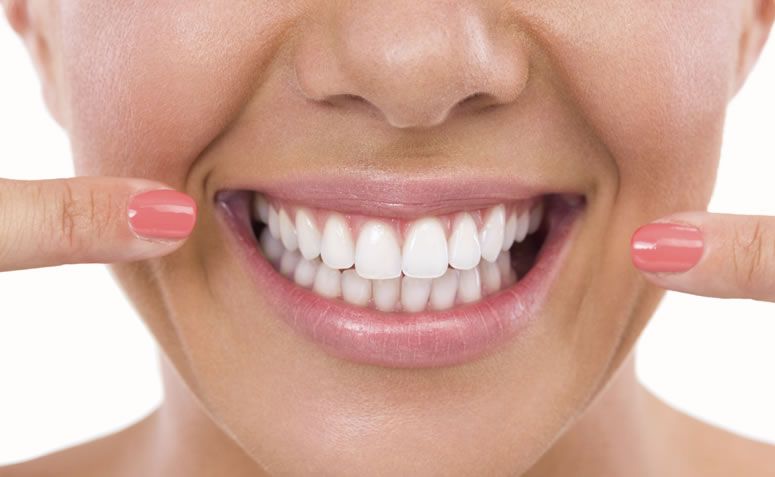 Mitos e verdades sobre o clareamento dental