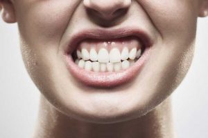 Cerca de 40% dos brasileiros são afetados por bruxismo
